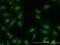 MAPK Activated Protein Kinase 2 antibody, H00009261-M01, Novus Biologicals, Immunocytochemistry image 