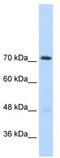 GTF2I Repeat Domain Containing 1 antibody, TA334243, Origene, Western Blot image 