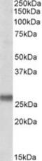 Synaptosome Associated Protein 23 antibody, MBS422433, MyBioSource, Western Blot image 