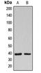 Beta-1,3-Galactosyltransferase 1 antibody, LS-C353081, Lifespan Biosciences, Western Blot image 