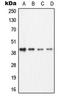 Branched Chain Amino Acid Transaminase 1 antibody, LS-C351861, Lifespan Biosciences, Western Blot image 