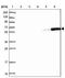 TACO antibody, NBP2-13861, Novus Biologicals, Western Blot image 