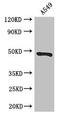 Eukaryotic Translation Initiation Factor 4A3 antibody, CSB-PA007553LA01HU, Cusabio, Western Blot image 