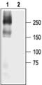 Sodium Voltage-Gated Channel Alpha Subunit 5 antibody, PA5-77725, Invitrogen Antibodies, Western Blot image 