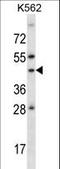 Adenosine receptor A1 antibody, LS-C156103, Lifespan Biosciences, Western Blot image 