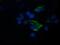 Tripartite Motif Containing 44 antibody, MA5-26158, Invitrogen Antibodies, Immunocytochemistry image 