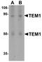 CD248 Molecule antibody, A04735, Boster Biological Technology, Western Blot image 