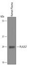 Phospholipase A2 Group VII antibody, PA5-47698, Invitrogen Antibodies, Western Blot image 