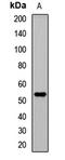 TNF Receptor Associated Factor 4 antibody, LS-C668304, Lifespan Biosciences, Western Blot image 