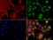 NME/NM23 Nucleoside Diphosphate Kinase 1 antibody, LS-C796837, Lifespan Biosciences, Immunofluorescence image 