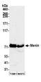 Menin 1 antibody, A300-105A, Bethyl Labs, Western Blot image 