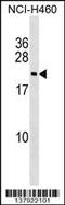 FUN14 Domain Containing 1 antibody, 59-157, ProSci, Western Blot image 
