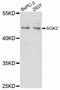 Serum/Glucocorticoid Regulated Kinase 2 antibody, abx126544, Abbexa, Western Blot image 