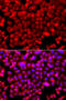 NADH:Ubiquinone Oxidoreductase Core Subunit V1 antibody, STJ110320, St John