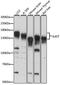 Interleukin 6 Signal Transducer antibody, A14656, ABclonal Technology, Western Blot image 