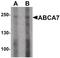 ATP Binding Cassette Subfamily A Member 7 antibody, PA5-34396, Invitrogen Antibodies, Western Blot image 