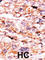 Activin A Receptor Type 2A antibody, abx033181, Abbexa, Western Blot image 