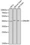 DnaJ homolog subfamily B member 4 antibody, 14-781, ProSci, Western Blot image 