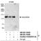 C2 Calcium Dependent Domain Containing 5 antibody, NB100-74595, Novus Biologicals, Immunoprecipitation image 