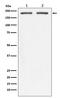 Integrin Subunit Beta 4 antibody, M01015, Boster Biological Technology, Western Blot image 