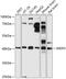 Cellular Communication Network Factor 6 antibody, 15-742, ProSci, Western Blot image 