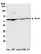 Aladin WD Repeat Nucleoporin antibody, A304-514A, Bethyl Labs, Western Blot image 
