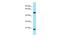 ALG10 Alpha-1,2-Glucosyltransferase B antibody, A13018, Boster Biological Technology, Western Blot image 