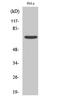 Frizzled Class Receptor 1 antibody, STJ93138, St John