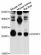 Insulin Like Growth Factor Binding Protein 1 antibody, abx125986, Abbexa, Western Blot image 