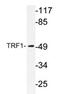 Telomeric repeat-binding factor 1 antibody, AP20371PU-N, Origene, Western Blot image 