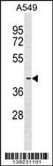 Fatty Acid Desaturase 3 antibody, 59-763, ProSci, Western Blot image 