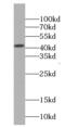 Eukaryotic Translation Initiation Factor 3 Subunit M antibody, FNab02715, FineTest, Western Blot image 