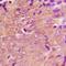 Galactosidase Beta 1 antibody, orb339032, Biorbyt, Immunohistochemistry paraffin image 
