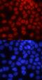 Pygopus Family PHD Finger 2 antibody, MA5-24240, Invitrogen Antibodies, Immunocytochemistry image 