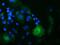 Oxysterol Binding Protein Like 11 antibody, MA5-25293, Invitrogen Antibodies, Immunocytochemistry image 