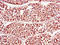 Cai antibody, A63126-100, Epigentek, Immunohistochemistry paraffin image 