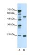 Cholinergic Receptor Nicotinic Beta 3 Subunit antibody, orb331574, Biorbyt, Western Blot image 