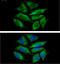 Translocase Of Outer Mitochondrial Membrane 20 antibody, GTX57716, GeneTex, Immunocytochemistry image 