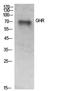 Growth Hormone Receptor antibody, STJ97268, St John