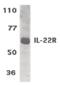 Interleukin 22 Receptor Subunit Alpha 1 antibody, PA5-19986, Invitrogen Antibodies, Western Blot image 