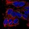 Solute Carrier Family 29 Member 3 antibody, NBP2-58806, Novus Biologicals, Immunocytochemistry image 