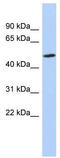 Zinc Finger Protein 329 antibody, TA341392, Origene, Western Blot image 