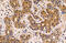 Mucin 1, Cell Surface Associated antibody, GTX100459, GeneTex, Immunohistochemistry paraffin image 
