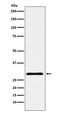 Chromobox protein homolog 7 antibody, M04742, Boster Biological Technology, Western Blot image 