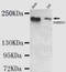 Lysine Demethylase 5C antibody, AM50089PU-N, Origene, Western Blot image 