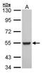 Retinoid X Receptor Beta antibody, GTX104798, GeneTex, Western Blot image 