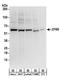 Zinc Finger Protein 622 antibody, A304-075A, Bethyl Labs, Western Blot image 