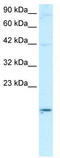 Apolipoprotein B MRNA Editing Enzyme Catalytic Subunit 3G antibody, TA333717, Origene, Western Blot image 