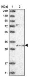 Translin-associated protein X antibody, PA5-56624, Invitrogen Antibodies, Western Blot image 