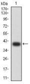 Glutamate Metabotropic Receptor 5 antibody, NBP2-61828, Novus Biologicals, Western Blot image 